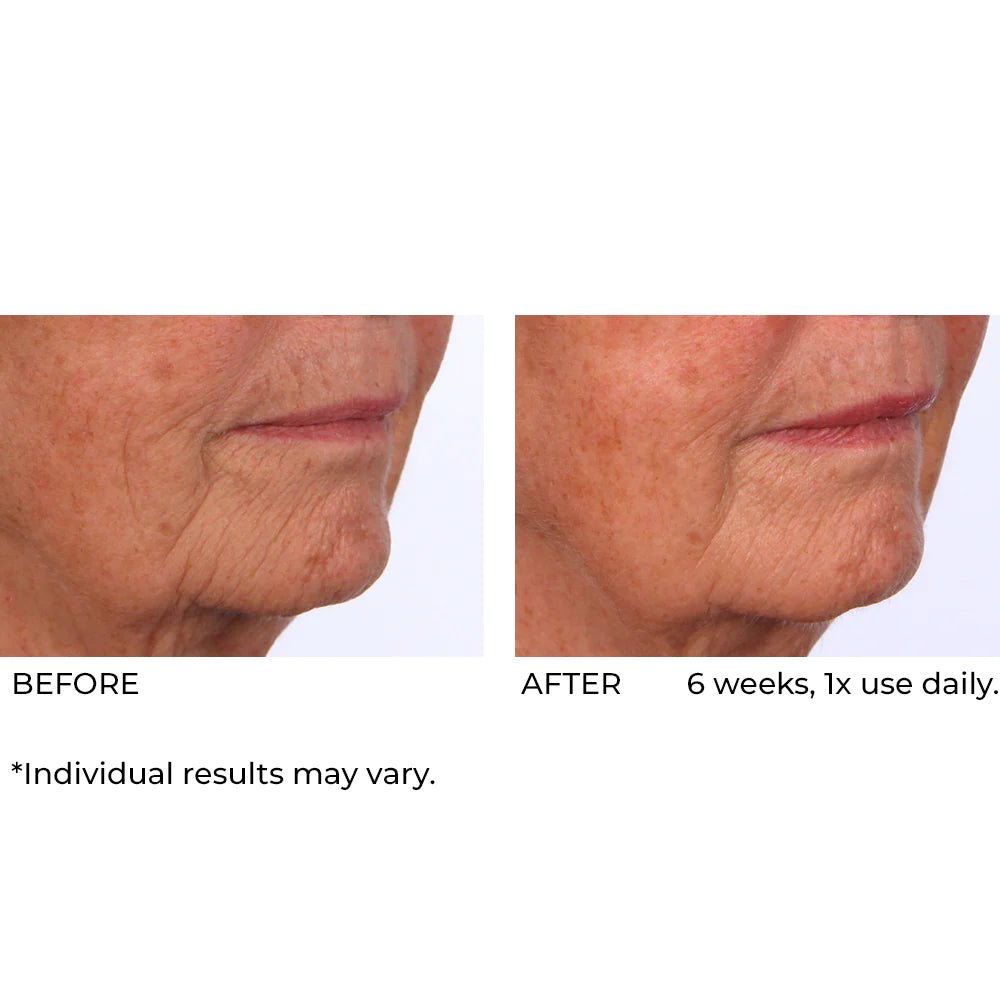 NassifMD Dermaflect Smart Day Therapy Cream 30ml