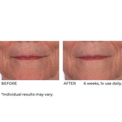 NassifMD Dermaflect Smart Day Therapy Cream 30ml