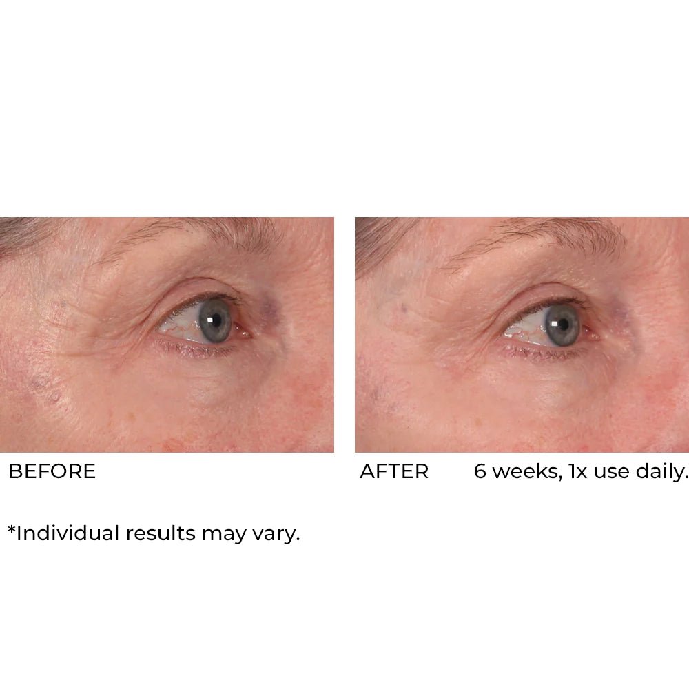 NassifMD Dermaflect Smart Day Therapy Cream 30ml