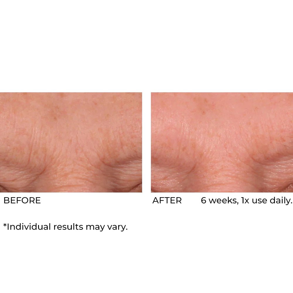 NassifMD Dermaflect Smart Day Therapy Cream 30ml