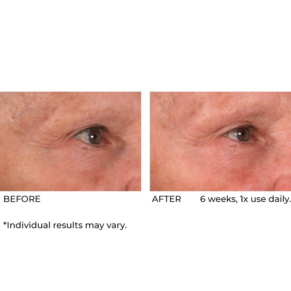 NassifMD Dermaflect Smart Day Therapy Cream 30ml