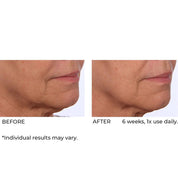 NassifMD Dermaflect Smart Day Therapy Cream 30ml