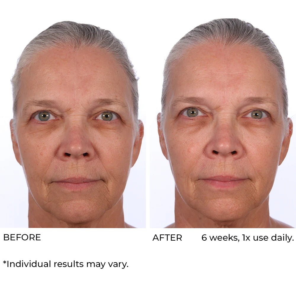 NassifMD Dermaflect Smart Day Therapy Cream 30ml