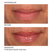 NassifMD Hydro - Screen For Lips 4ml