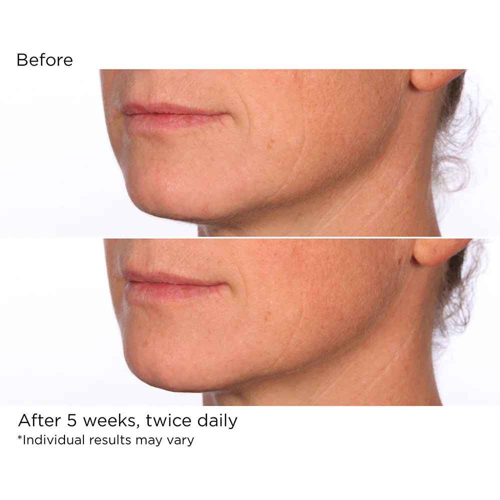 NassifMD Hydro - Screen® Hydrating Serum 30ml (Gift not for sale)