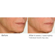 NassifMD Night Therapy Antioxidant Serum with Elasta - Derm C 30ml