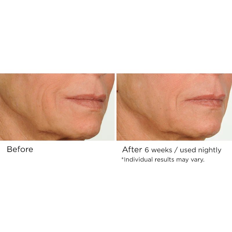 NassifMD Night Therapy Antioxidant Serum with Elasta - Derm C 30ml