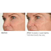 NassifMD Night Therapy Antioxidant Serum with Elasta - Derm C 30ml