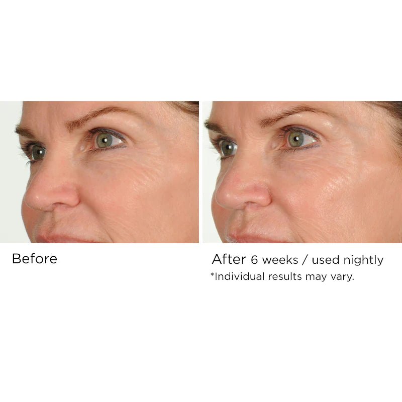 NassifMD Night Therapy Antioxidant Serum with Elasta - Derm C 30ml