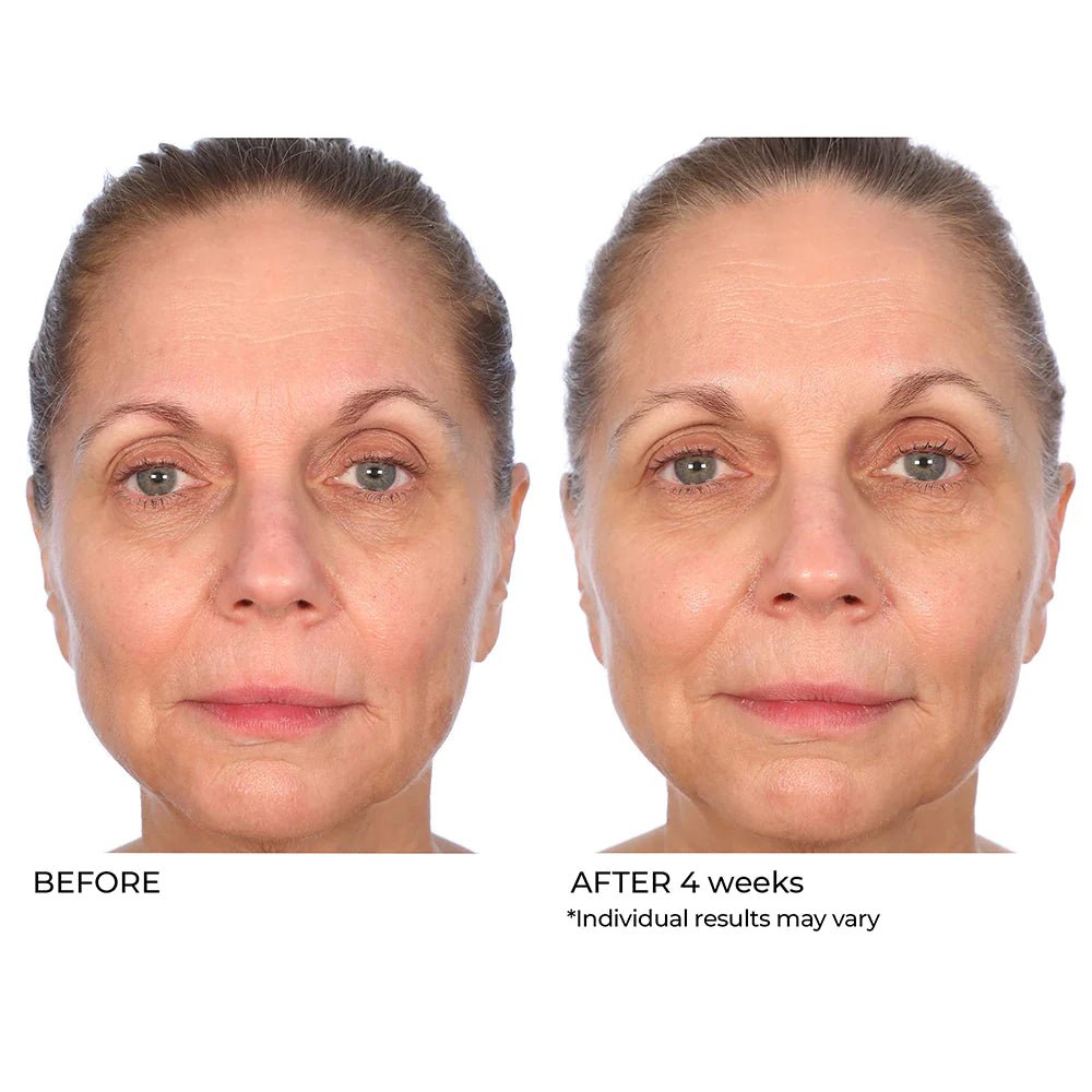 NassifMD Radiance Brightening Booster with Potent Vitamin C and F Complex