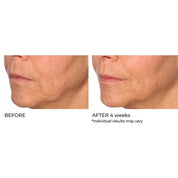 NassifMD Radiance Brightening Booster with Potent Vitamin C and F Complex