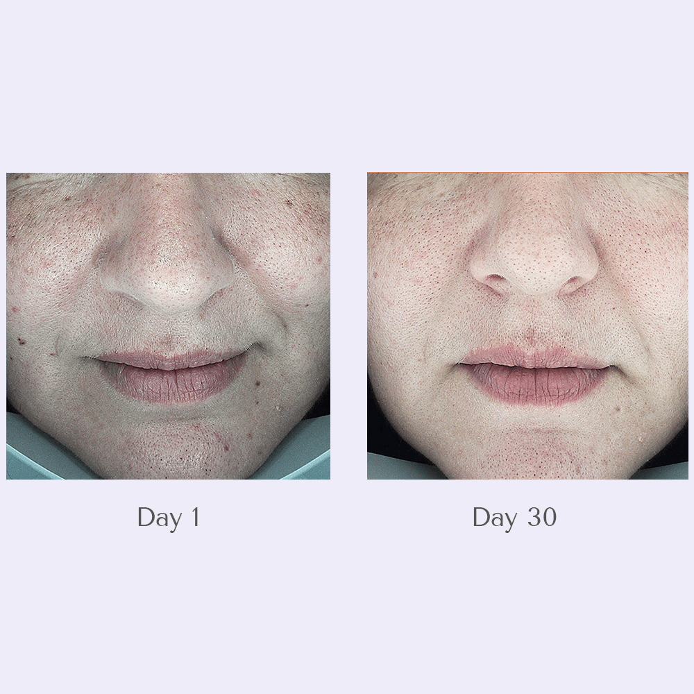 Youth Lab Dark Spot Remover Serum 30ml