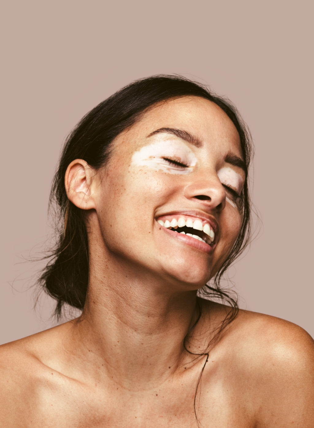 Chris and alley lady being happy, with pigmentation