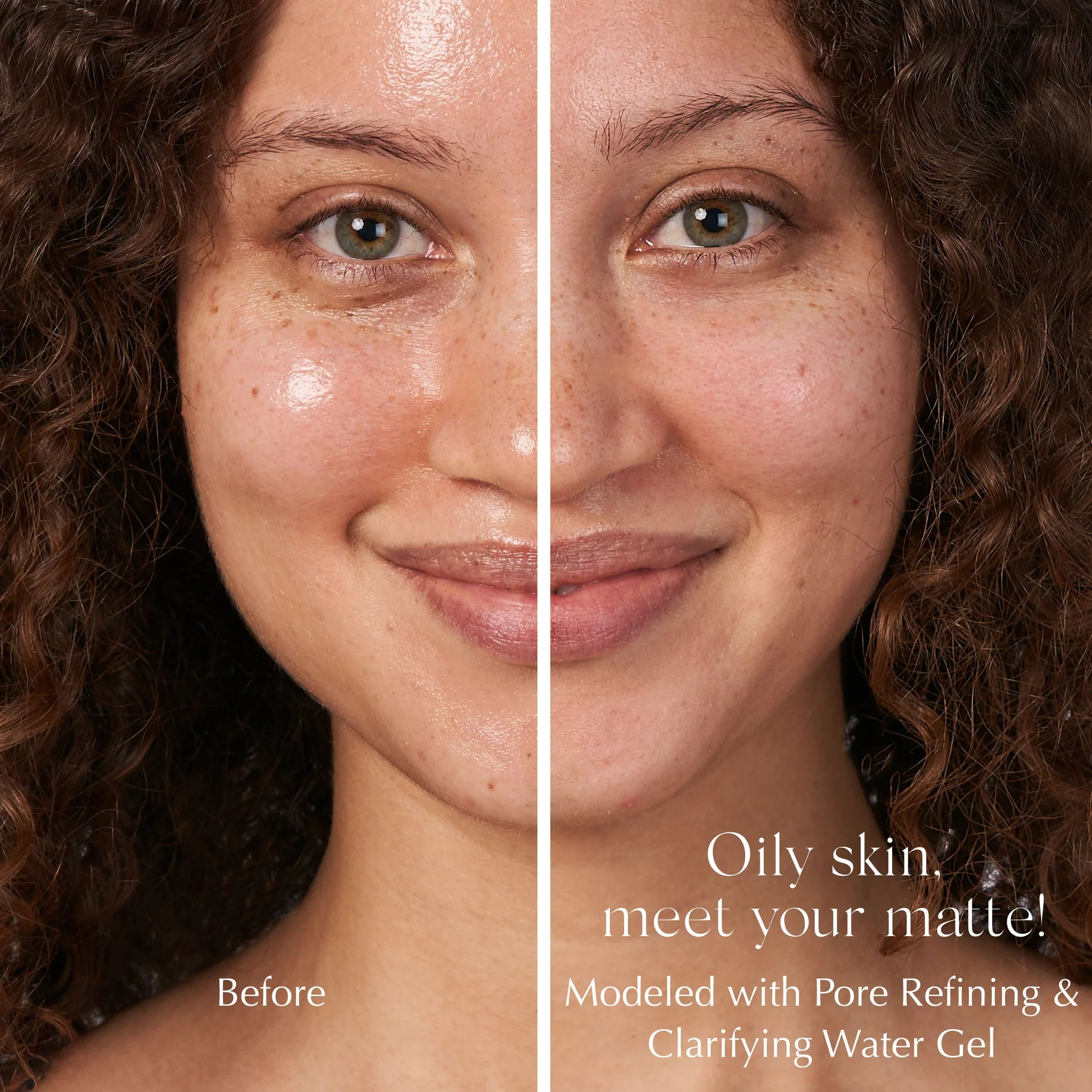 ex_PDP_PoreRefiningAndClarifyingWaterGelAdvancedToningNeckCream_BeforeAfter_05.webp