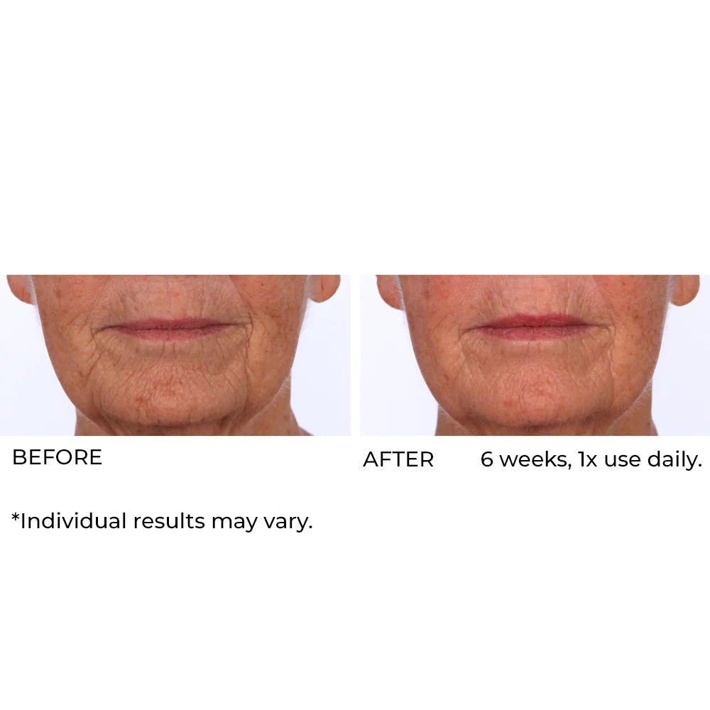 NassifMD Dermaflect Smart Day Therapy Cream 30ml