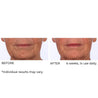 NassifMD Dermaflect Smart Day Therapy Cream 30ml