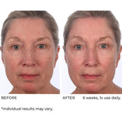 NassifMD Dermaflect Smart Day Therapy Cream 30ml