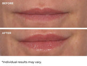 NassifMD Hydro - Screen For Lips 4ml