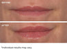 NassifMD Hydro - Screen For Lips 4ml