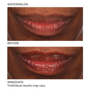 NassifMD Hydro - Screen For Lips 4ml