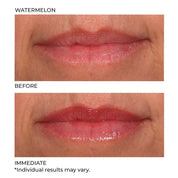 NassifMD Hydro - Screen For Lips 4ml