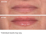 NassifMD Hydro - Screen For Lips 4ml