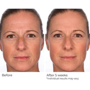 NassifMD Hydro - Screen® Hydrating Serum 120ml