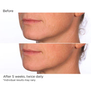 NassifMD Hydro - Screen® Hydrating Serum 30ml (Gift not for sale)