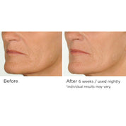 NassifMD Night Therapy Antioxidant Serum with Elasta - Derm C 30ml