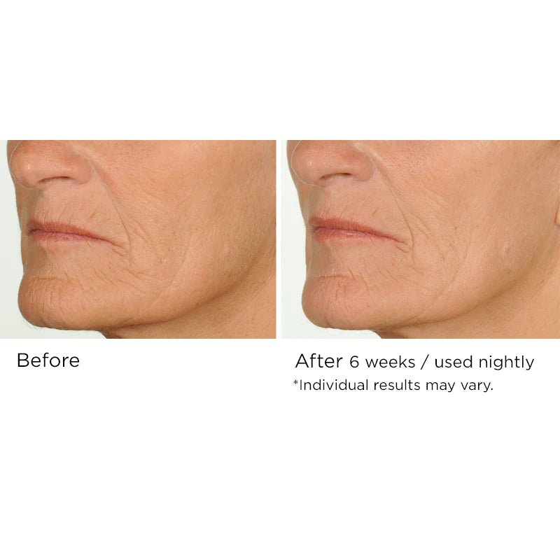 NassifMD Night Therapy Antioxidant Serum with Elasta - Derm C 30ml