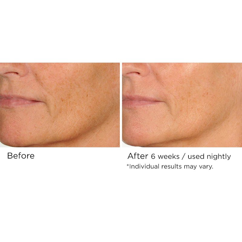 NassifMD Night Therapy Antioxidant Serum with Elasta - Derm C 30ml