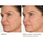 NassifMD Night Therapy Antioxidant Serum with Elasta - Derm C 30ml