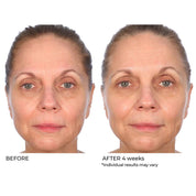 NassifMD Radiance Brightening Booster with Potent Vitamin C and F Complex