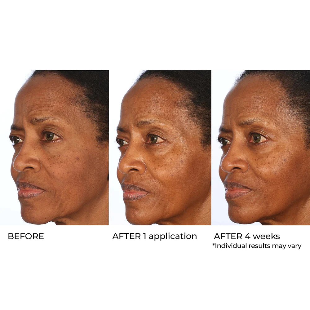 NassifMD Radiance Brightening Booster with Potent Vitamin C and F Complex