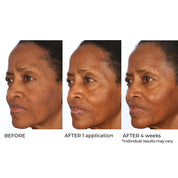 NassifMD Radiance Brightening Booster with Potent Vitamin C and F Complex