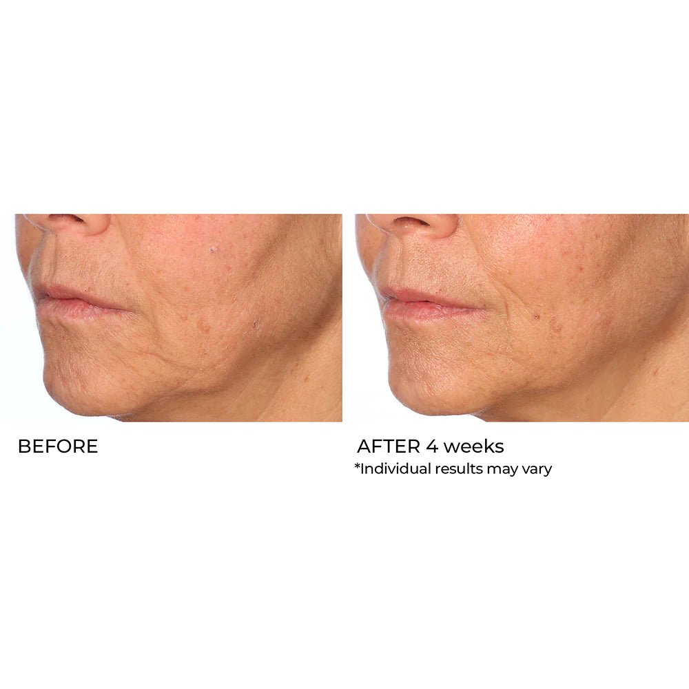 NassifMD Radiance Brightening Booster with Potent Vitamin C and F Complex